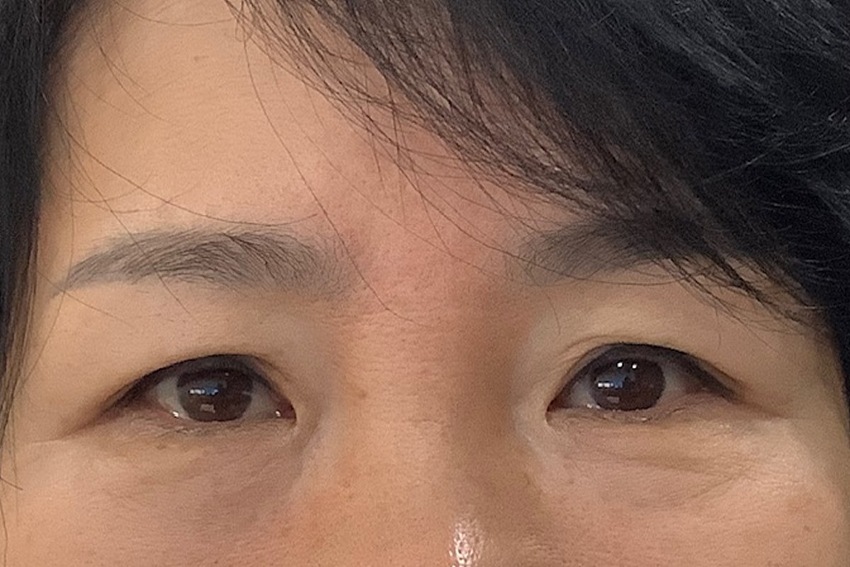 눈썹하거상 전